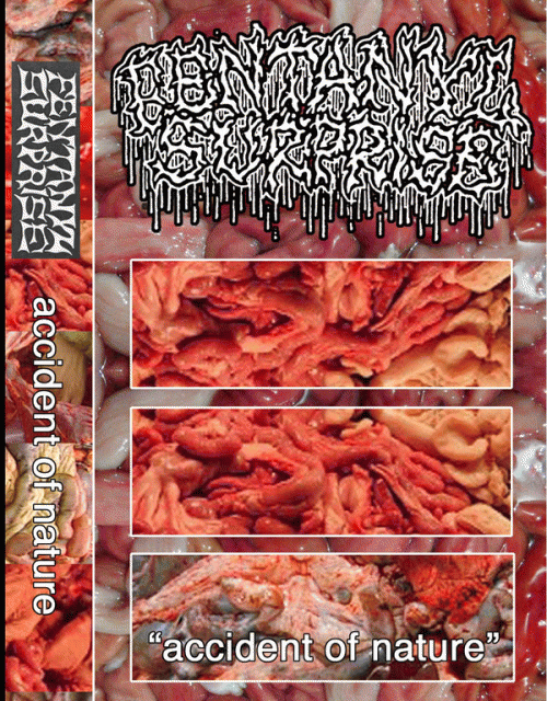 Fentanyl Surprise : Accident of Nature